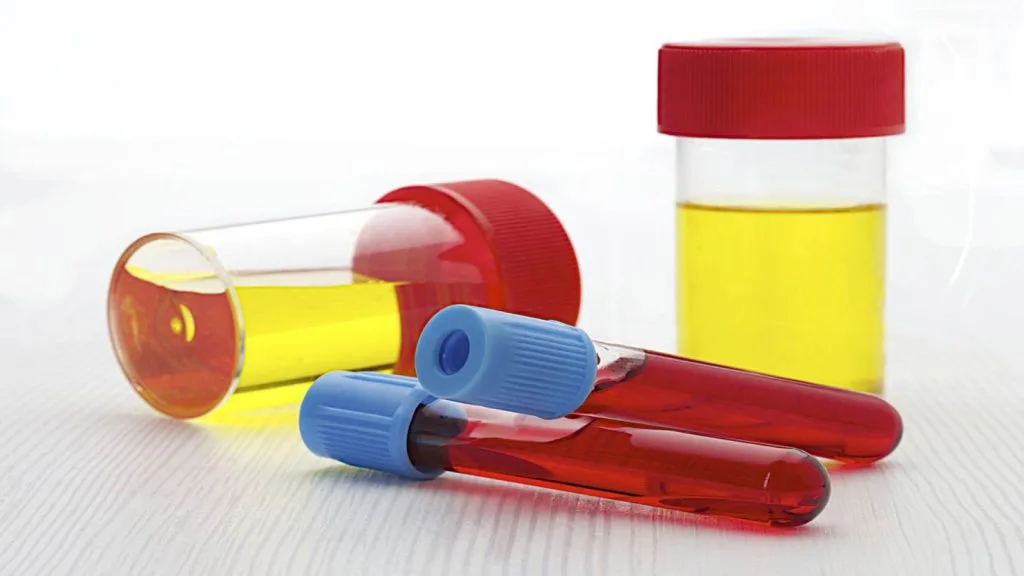 خون در ادرار در گروه‌های مختلف