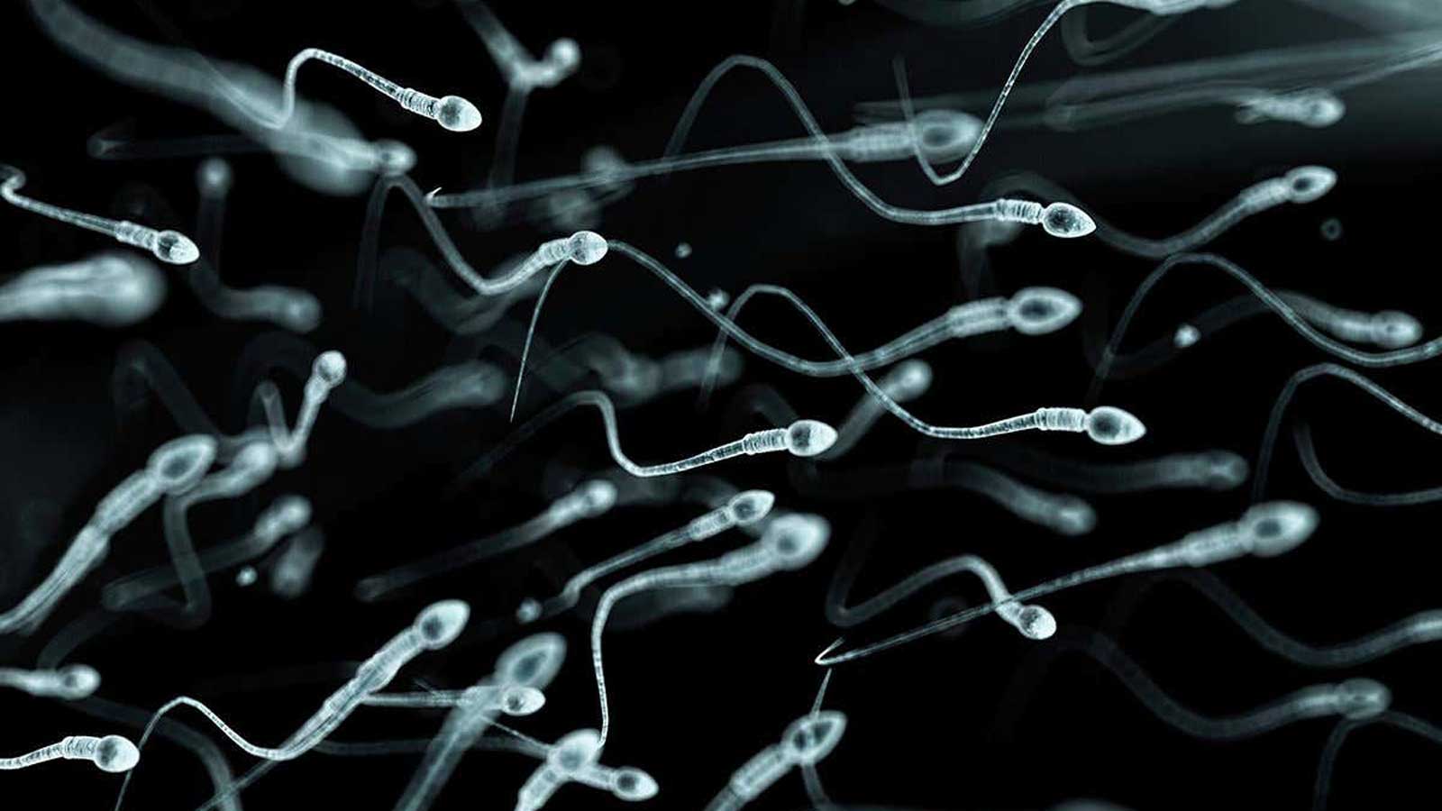آزمایش اسپرم و نتایج آن