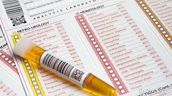 هر آنچه باید در مورد آزمایش ادرار بدانید