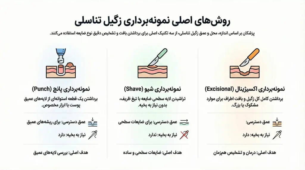 انواع روش های نمونه برداری زگیل تناسلی