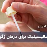 اسید سالیسیلیک برای درمان زگیل