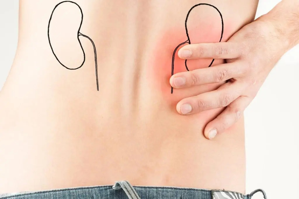 علائم نارسایی کلیه