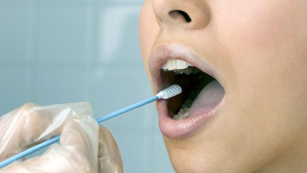 تشخیص ویروس اچ پی وی در دهان