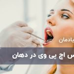 ظاهر شدن نشانه های اچ پی وی و زگیل تناسلی در دهان