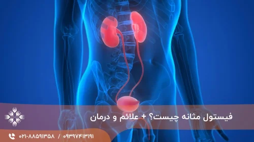 فیستول مثانه