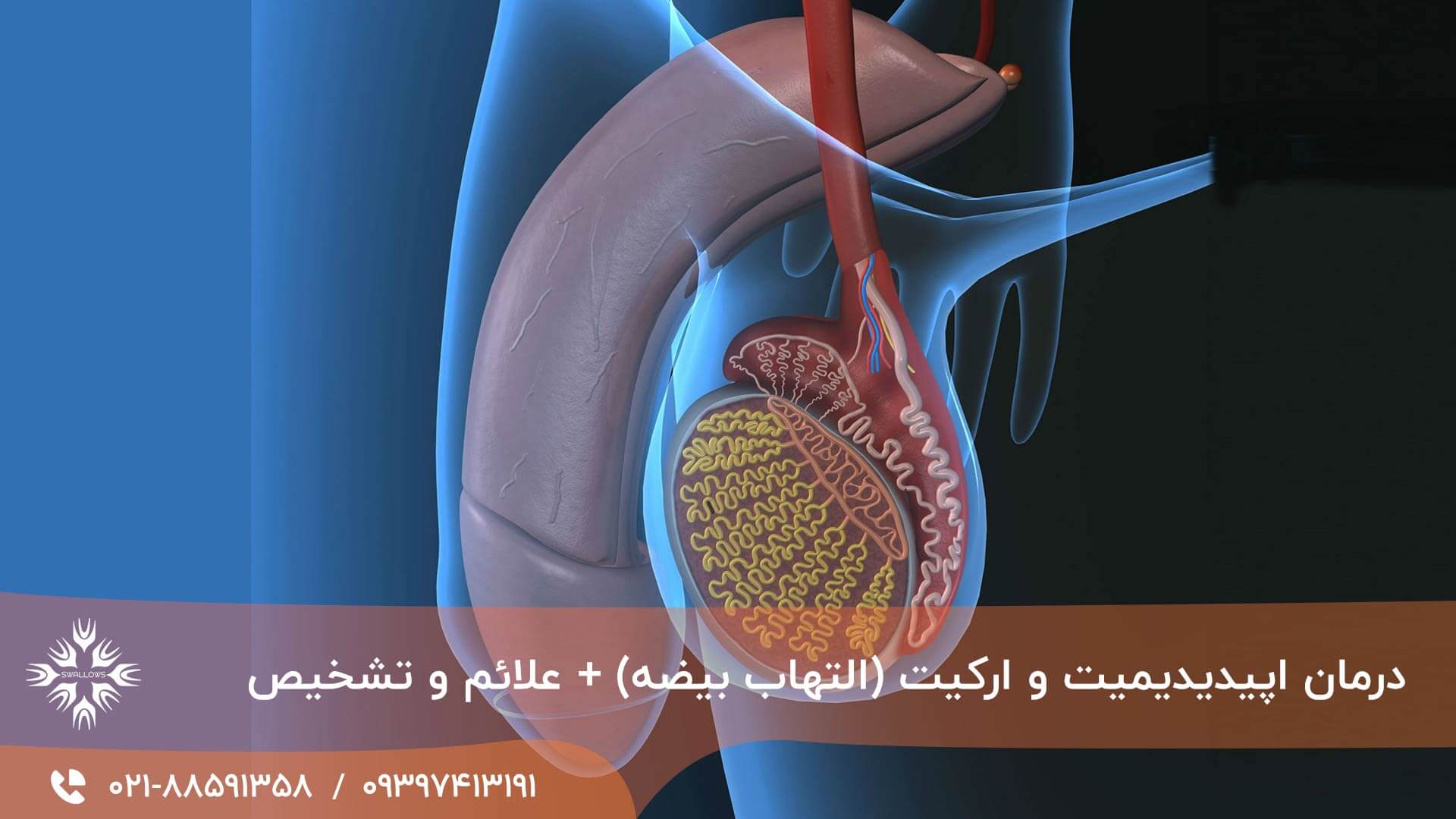 اپیدیدیمیت