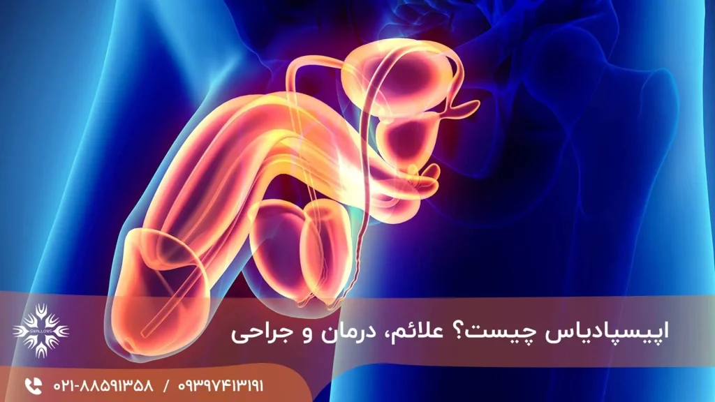 اپیسپادیاس