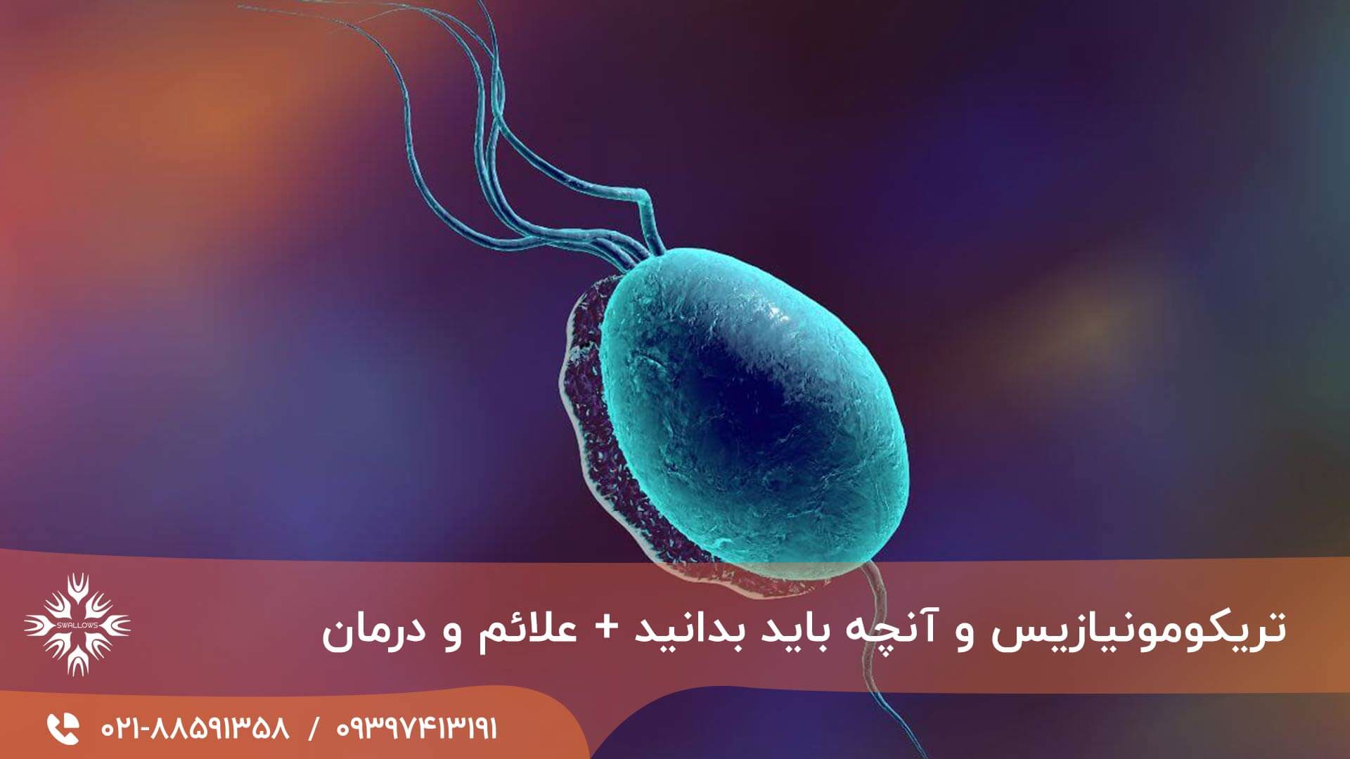 تریکومونیازیس