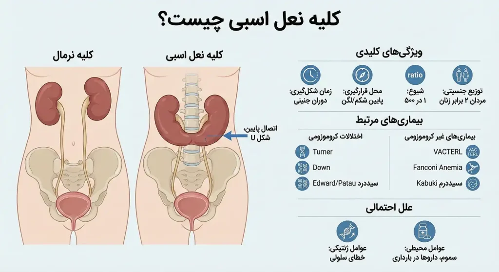 کلیه نعل اسبی چیست