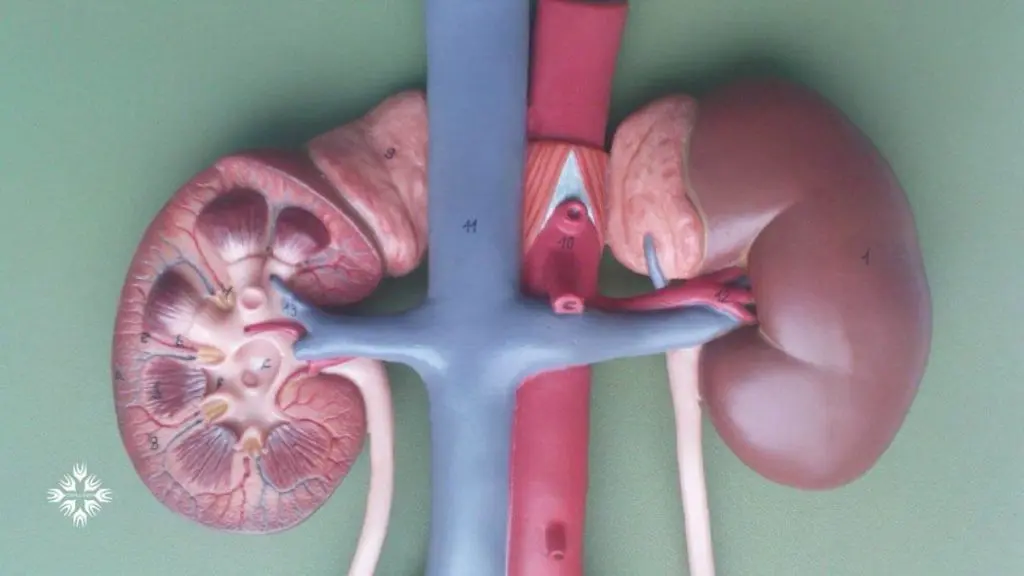کلیه اکتوپیک یا کلیه نابجا چیست