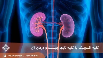 کلیه اکتوپیک یا کلیه نابجا چیست ؟ توضیحات کامل همراه با درمان