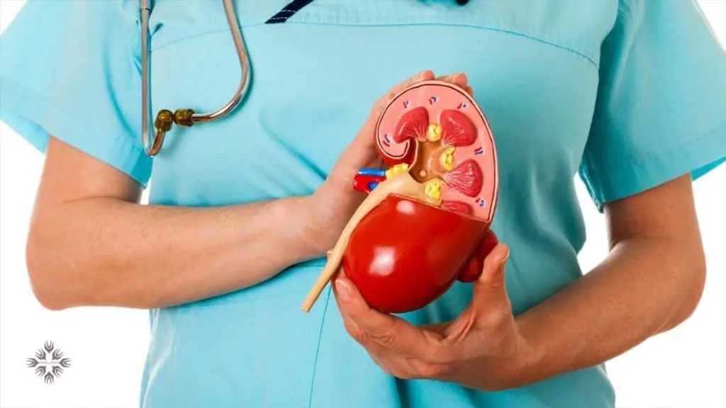 درمان کلیه نعل اسبی