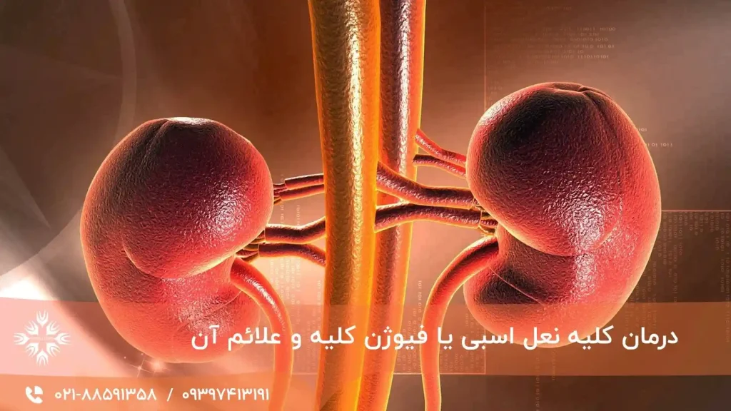 کلیه نعل اسبی