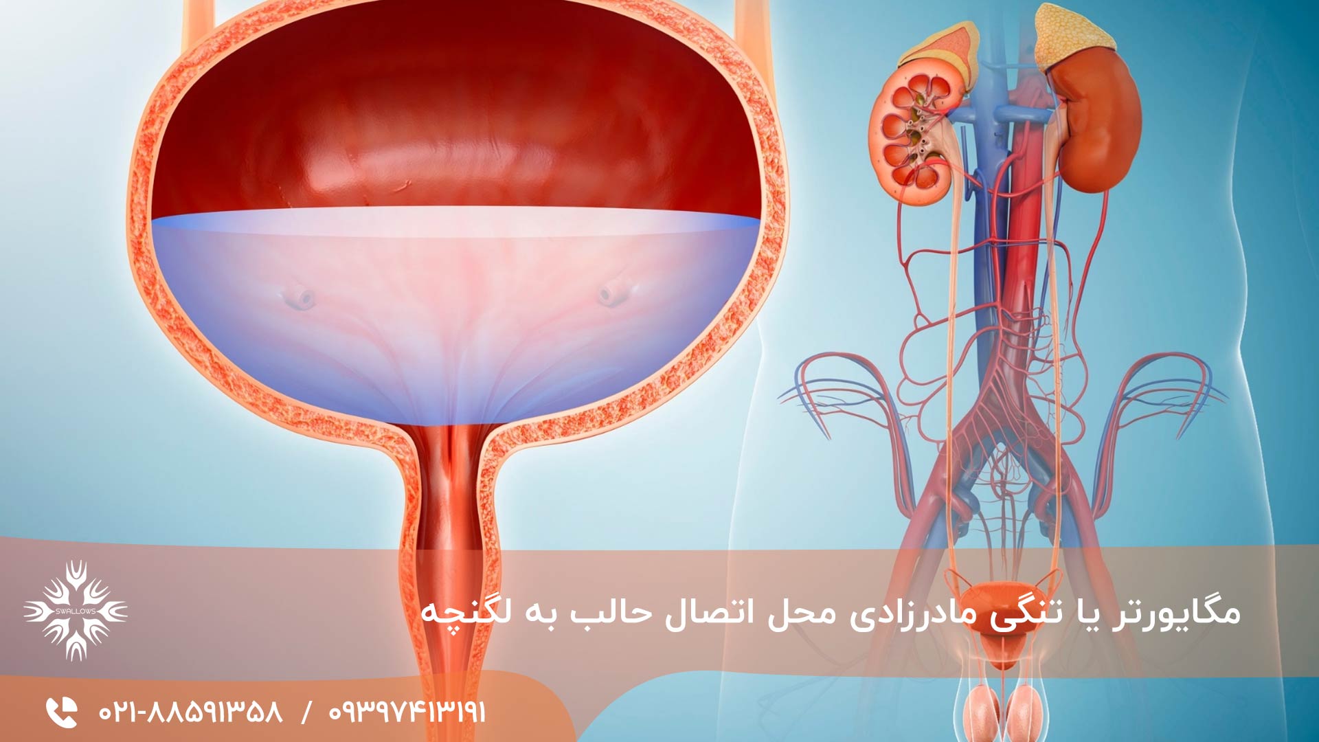 مگایورتر