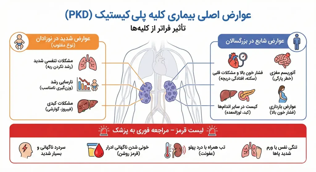 عوارض بیماری کلیه پلی کیستیک