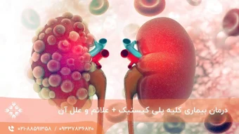 درمان بیماری کلیه پلی کیستیک + علائم و علل آن
