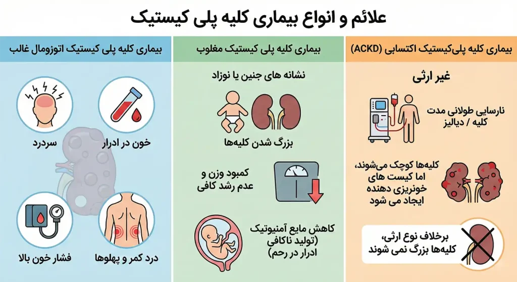 علائم بیماری کلیه پلی کیستیک