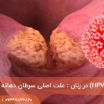 اچ پی وی (HPV) در زنان : علت اصلی سرطان دهانه رحم
