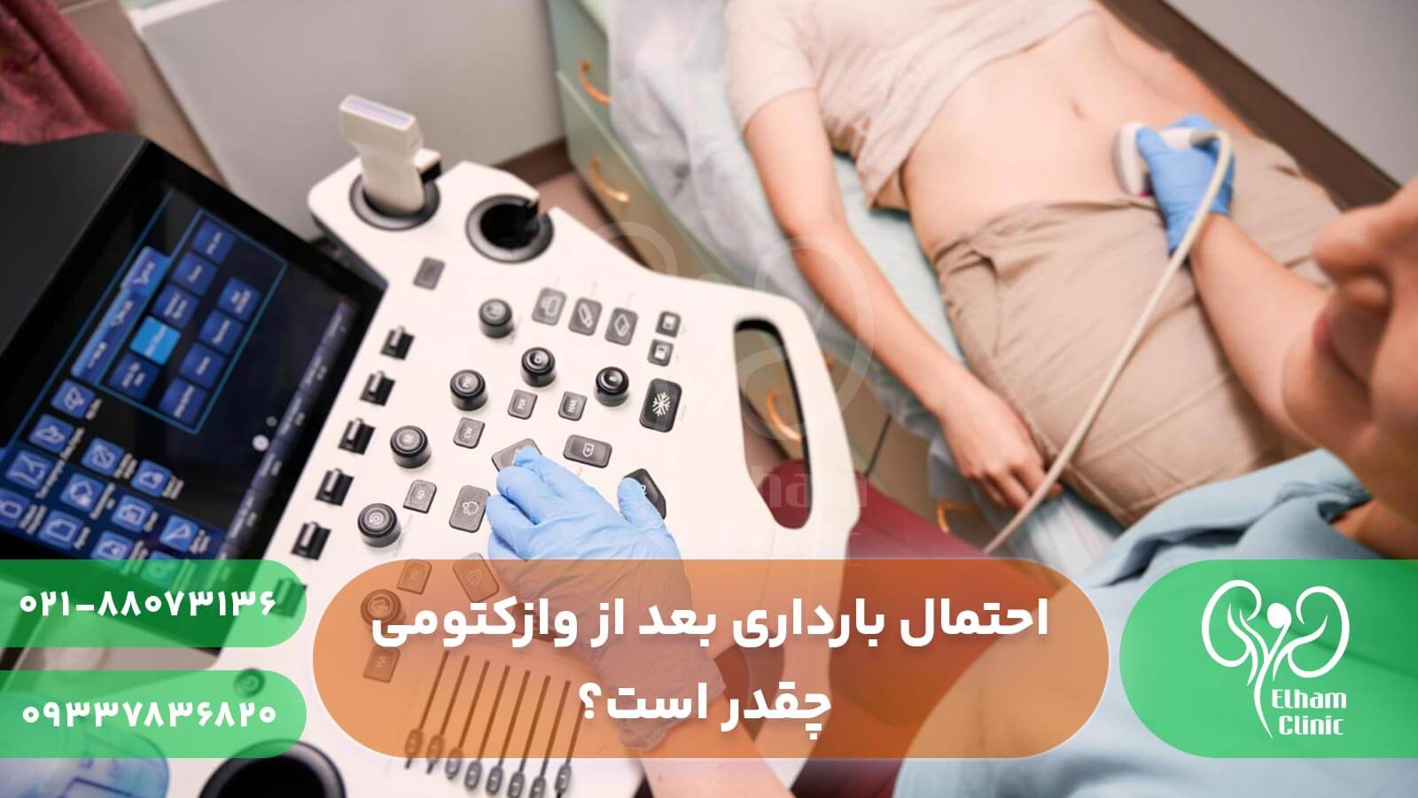 احتمال بارداری بعد از وازکتومی چقدر است