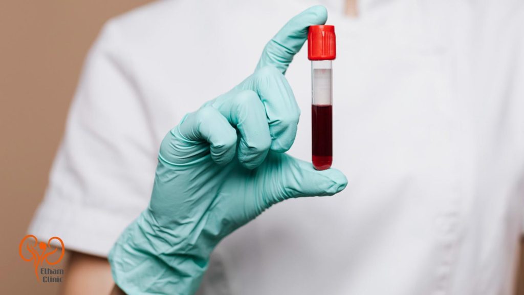 آزمایش خون برای تقویت نعوظ در مردان