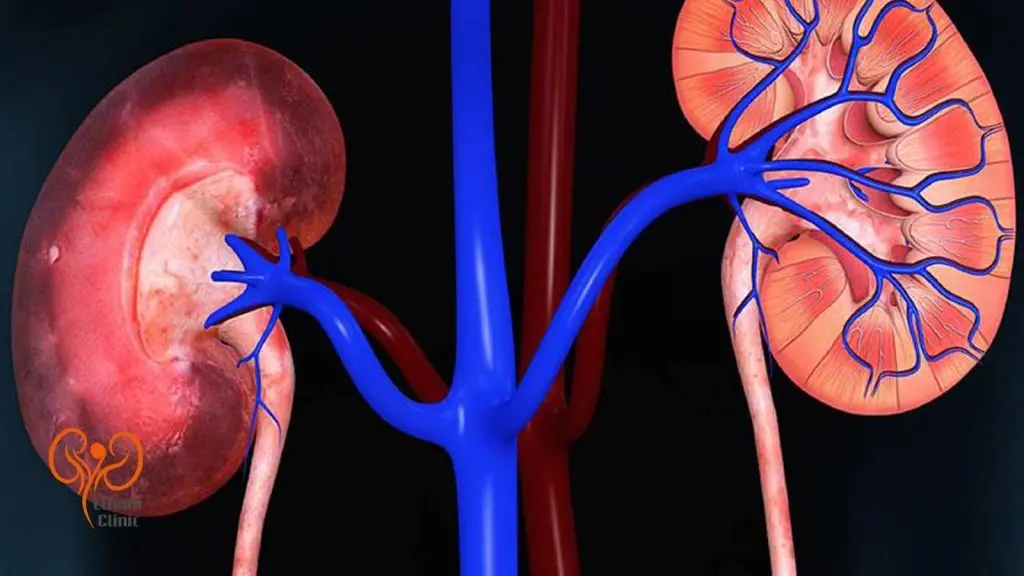 ازوتمی پیش کلیوی