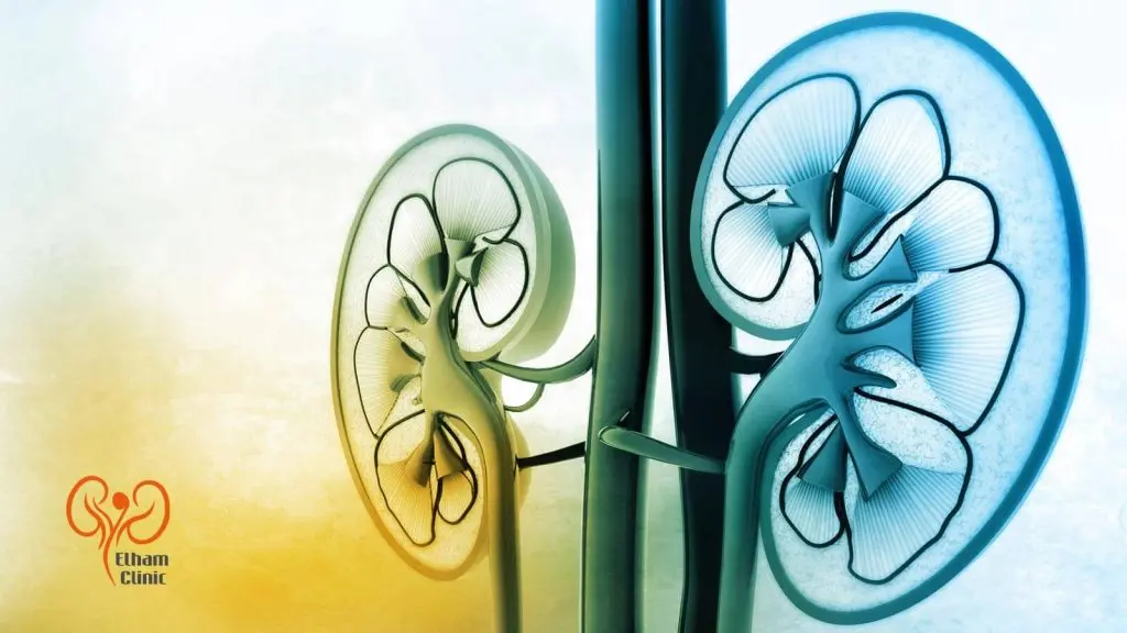 انواع ازوتمی