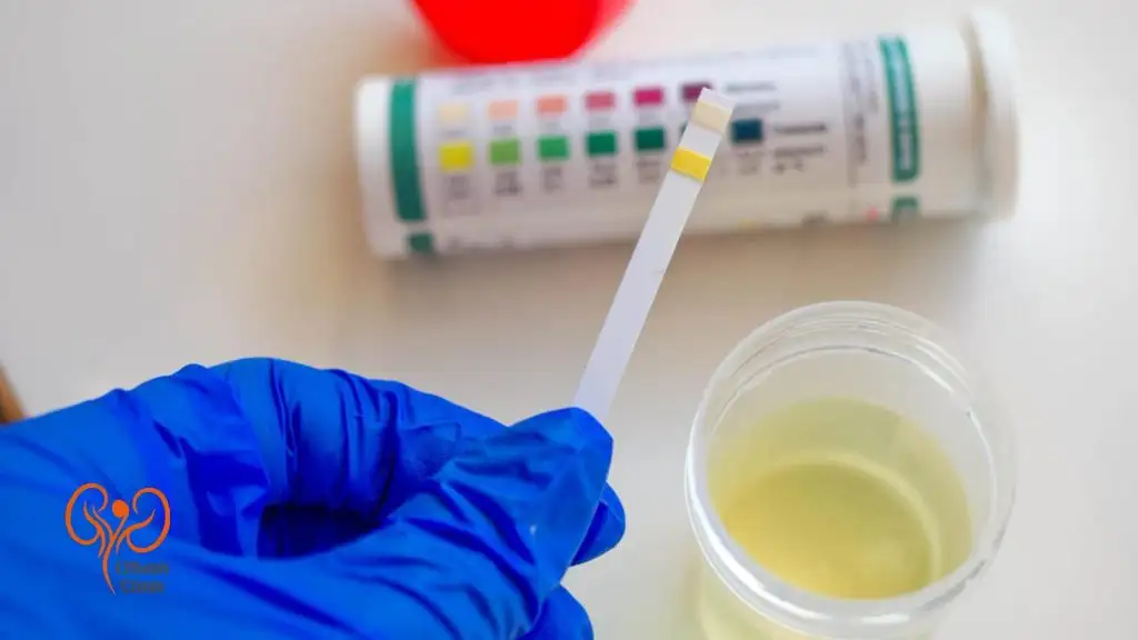 انواع پروتئینوری (دفع پروتئین در ادرار)