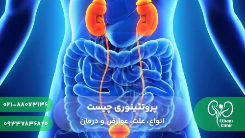 پروتئینوری یا دفع پروتئین در ادرار