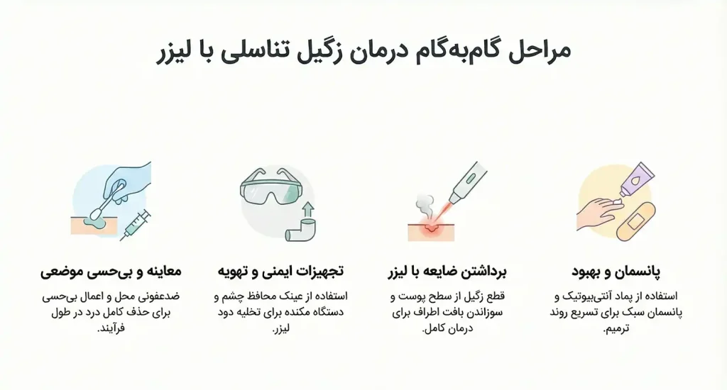 نحوه انجام لیزر زگیل تناسلی