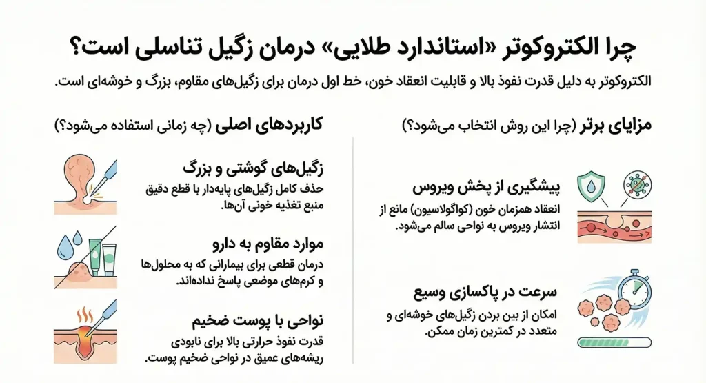 کاربردهای سوزاندن زگیل تناسلی