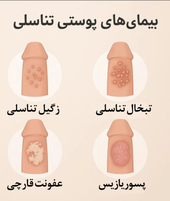 عکس بیماری های پوستی دستگاه تناسلی