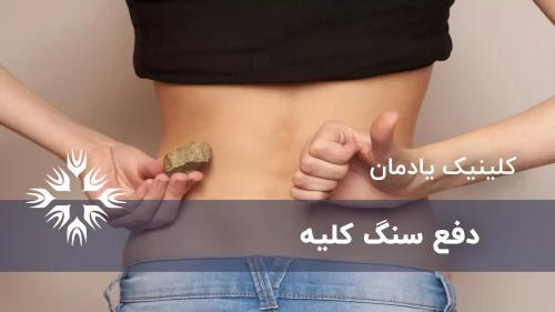 دفع سنگ کلیه چه مدت طول می کشد؟
