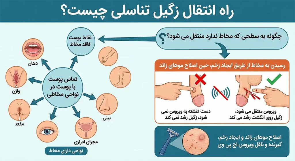 راه انتقال زگیل تناسلی چیست